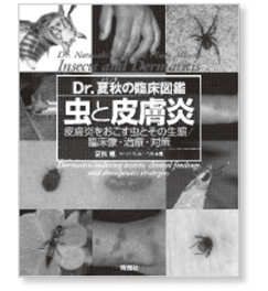 私の一冊】『Dr.夏秋の臨床図鑑 虫と皮膚炎』 – 日本医事新報社