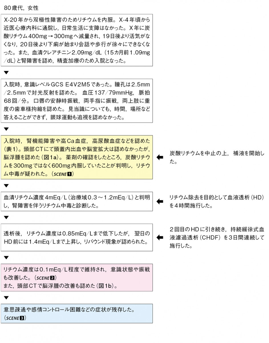 リチウム中毒をきたした女性［難渋症例から学ぶ診療のエッセンス（196